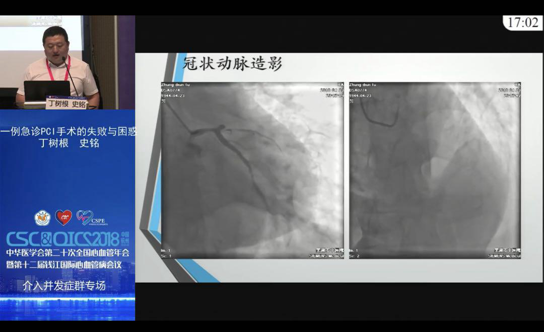 我院心內(nèi)科受邀在2018全國心血管年會做精彩病例報告(圖4)